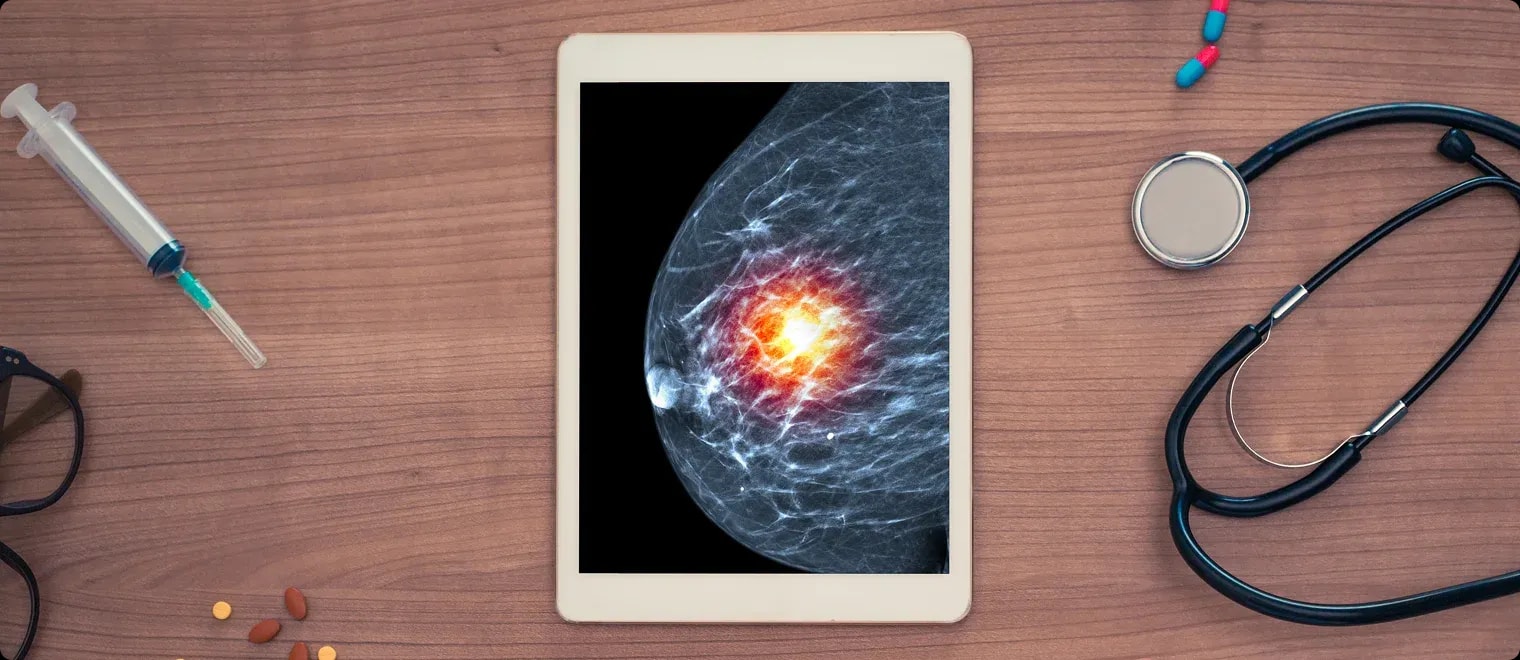 Breast Cancer HER2 Subtype Identification