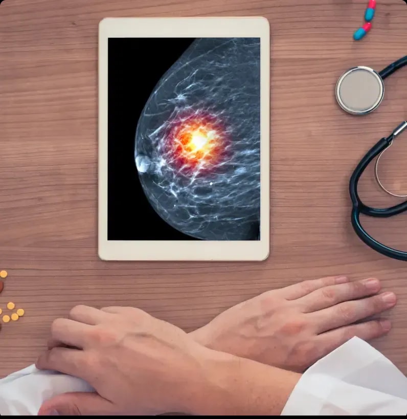 Breast Cancer HER2 Subtype Identification