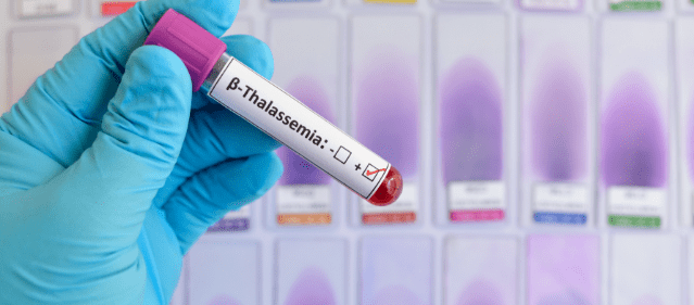 Thalassemia Identification Image Analysis Breast Cancer HER2 Subtype Identification Computer Vision