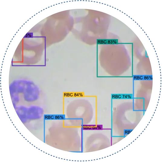 solution- cell counting